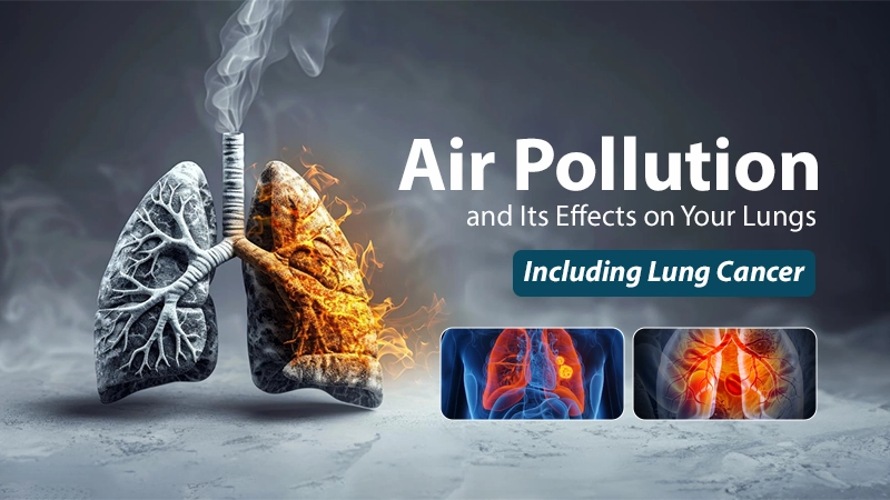 Air Pollution and Its Effects on Your Lungs — Including Lung Cancer Service
